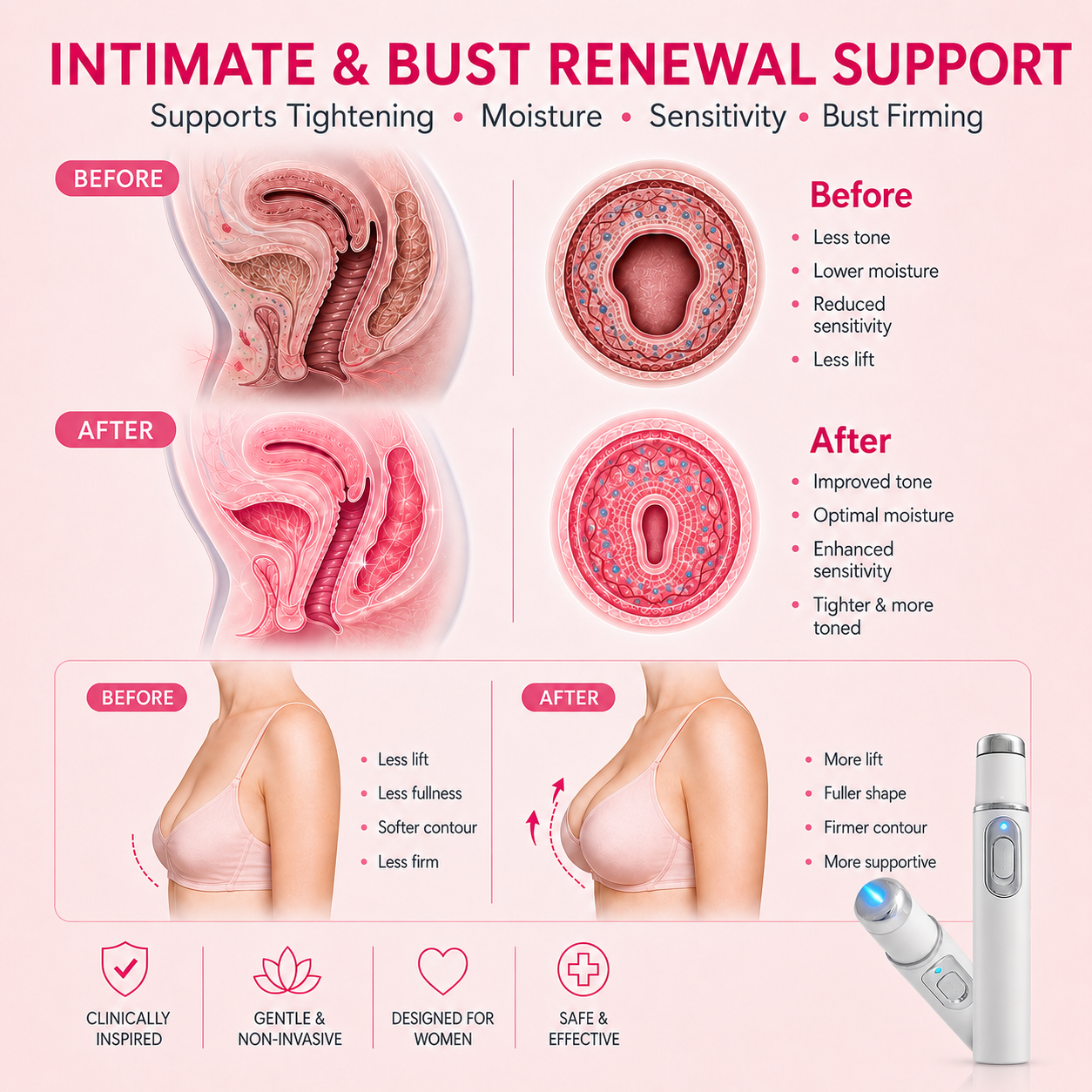 VELYSSA™ Ultrasonic Women's Intimate Tightening, Sensitivity & Full-Body Renewal Device✅ Vaginal Repair✅ HPV Defense✅ Curve Sculpting