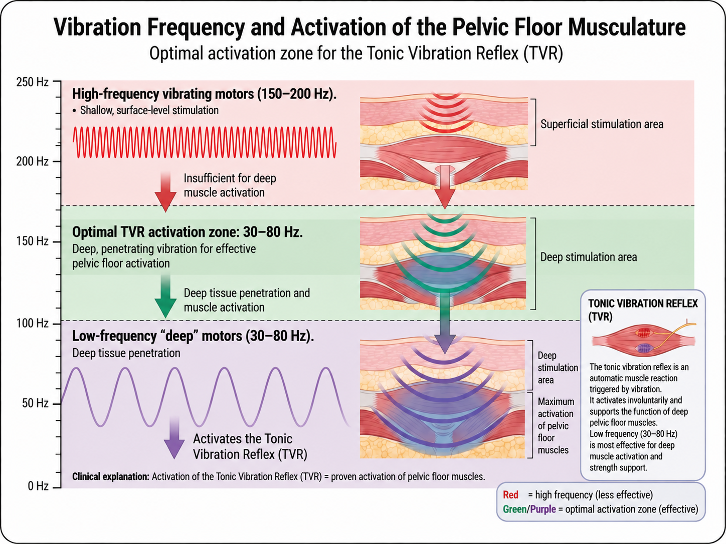 Targeted vibration frequency diagram