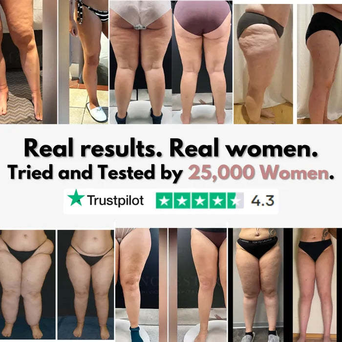 Cellumove 3D legging - say goodbye to lipedema pain and swelling naturally