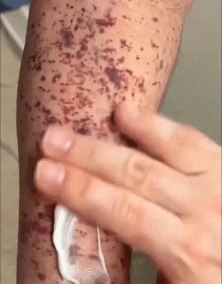18.gif