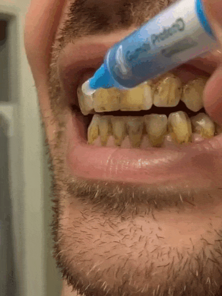 21.gif