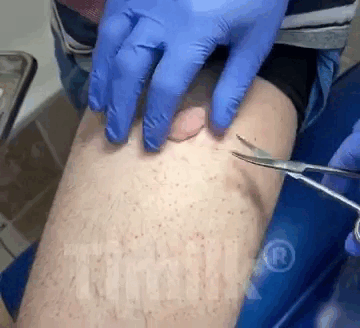 4.gif