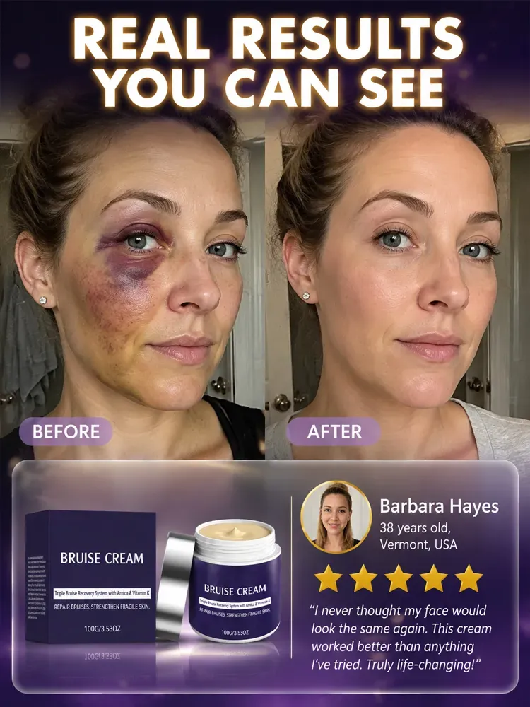 🩹 Dermatologist Recommended Bruise Recovery Cream – Triple Repair System with Arnica & Vitamin K Fades Dark Bruises in 7 Days