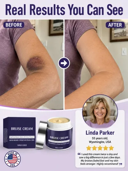 🩹 Dermatologist Recommended Bruise Recovery Cream – Triple Repair System with Arnica & Vitamin K Fades Dark Bruises in 7 Days