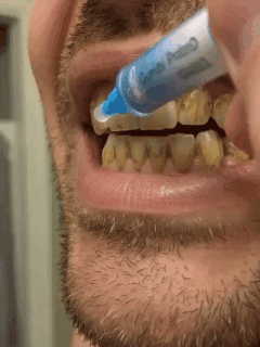 8.gif