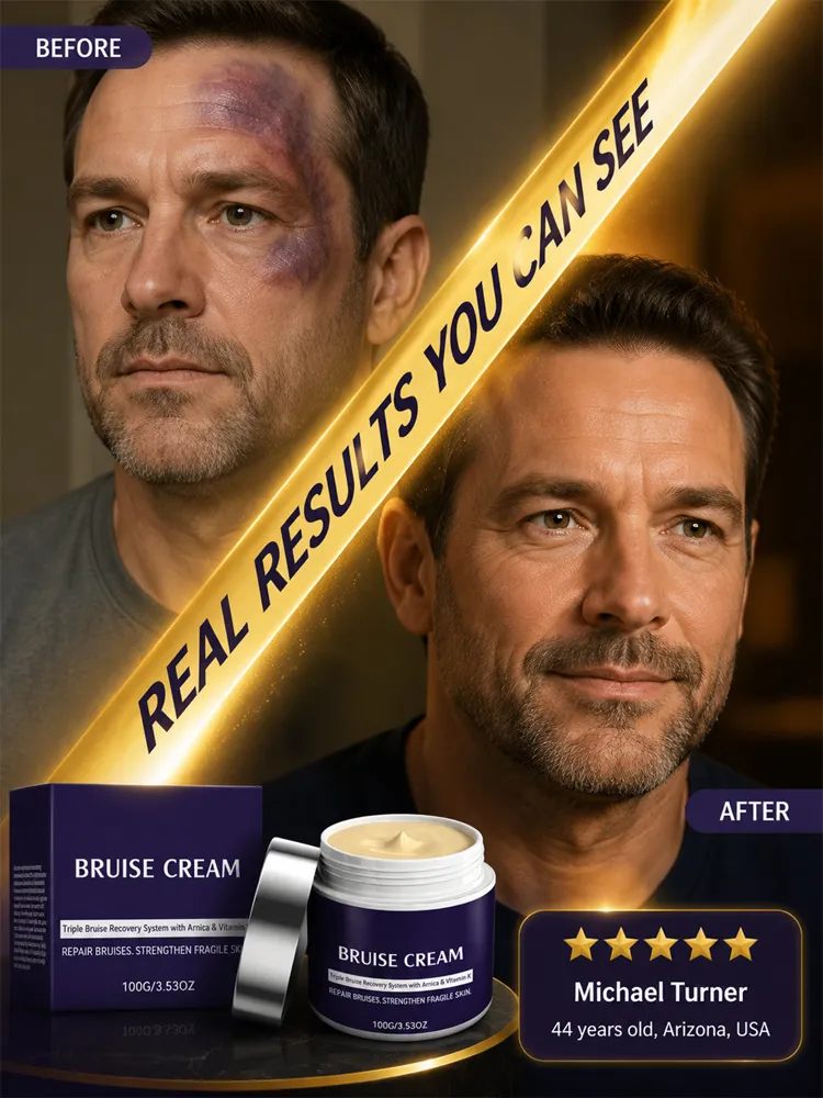 🩹 Dermatologist Recommended Bruise Recovery Cream – Triple Repair System with Arnica & Vitamin K Fades Dark Bruises in 7 Days