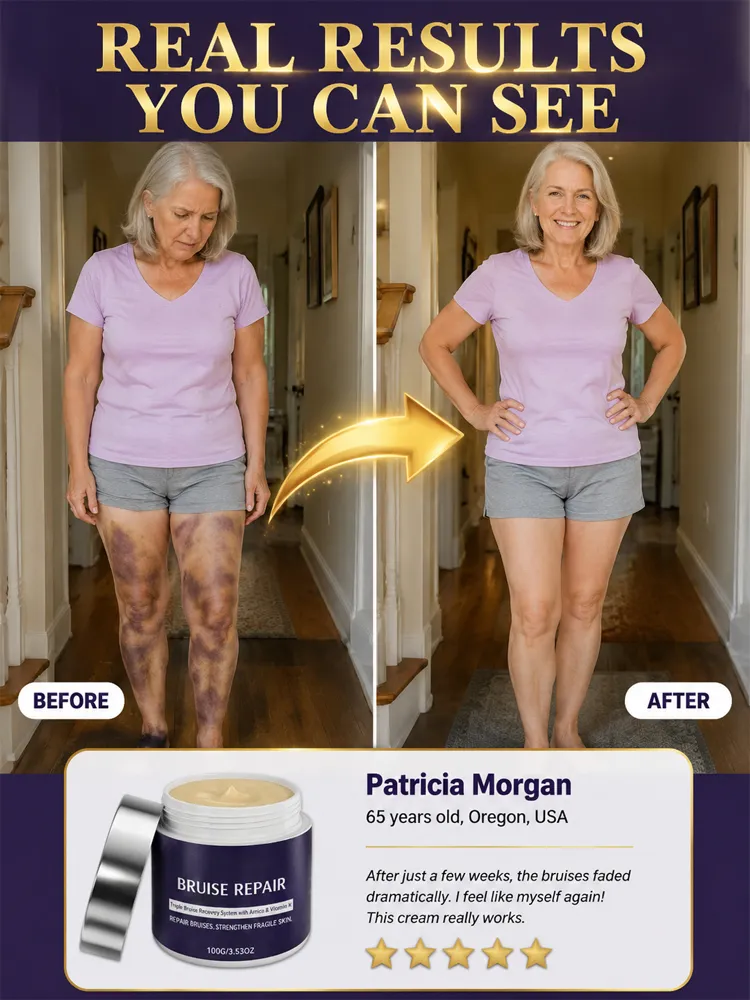 🩹 Dermatologist Recommended Bruise Recovery Cream – Triple Repair System with Arnica & Vitamin K Fades Dark Bruises in 7 Days