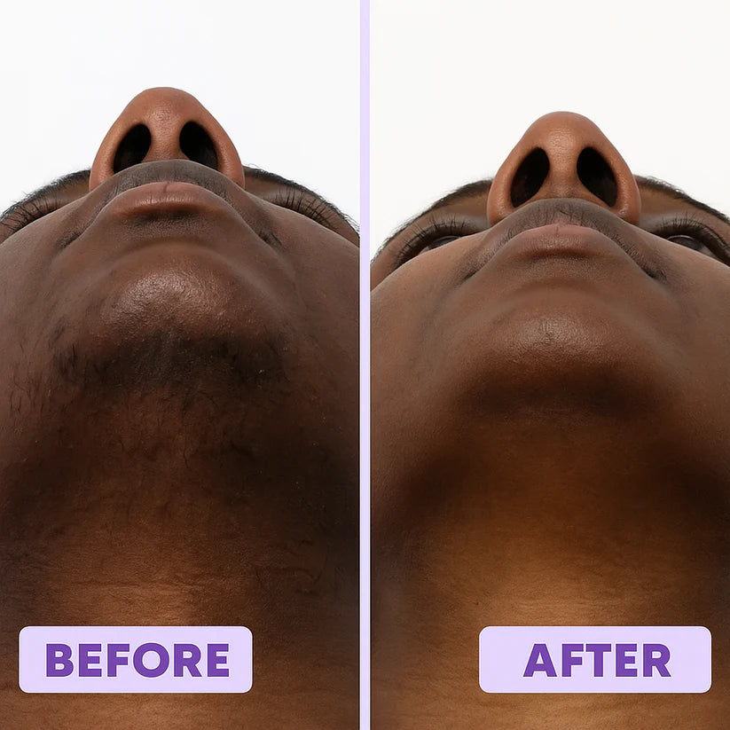 Gentle Facial Hair Removal Cream
