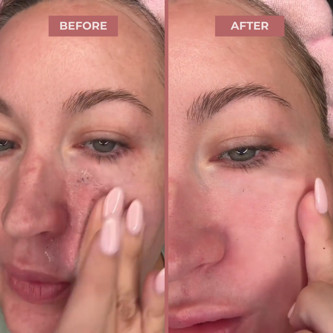White & Black Rice Niacinamide Brightening Exfoliating Serum