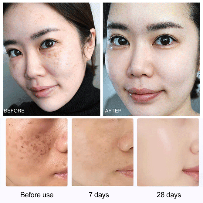 【✨POPASKIN 577+377 Intensive Dark Spot Correcting & Brightening Cream 30g✨】Suitable for sensitive skin, brightens the complexion, non-greasy, absorbs instantly, lightweight texture