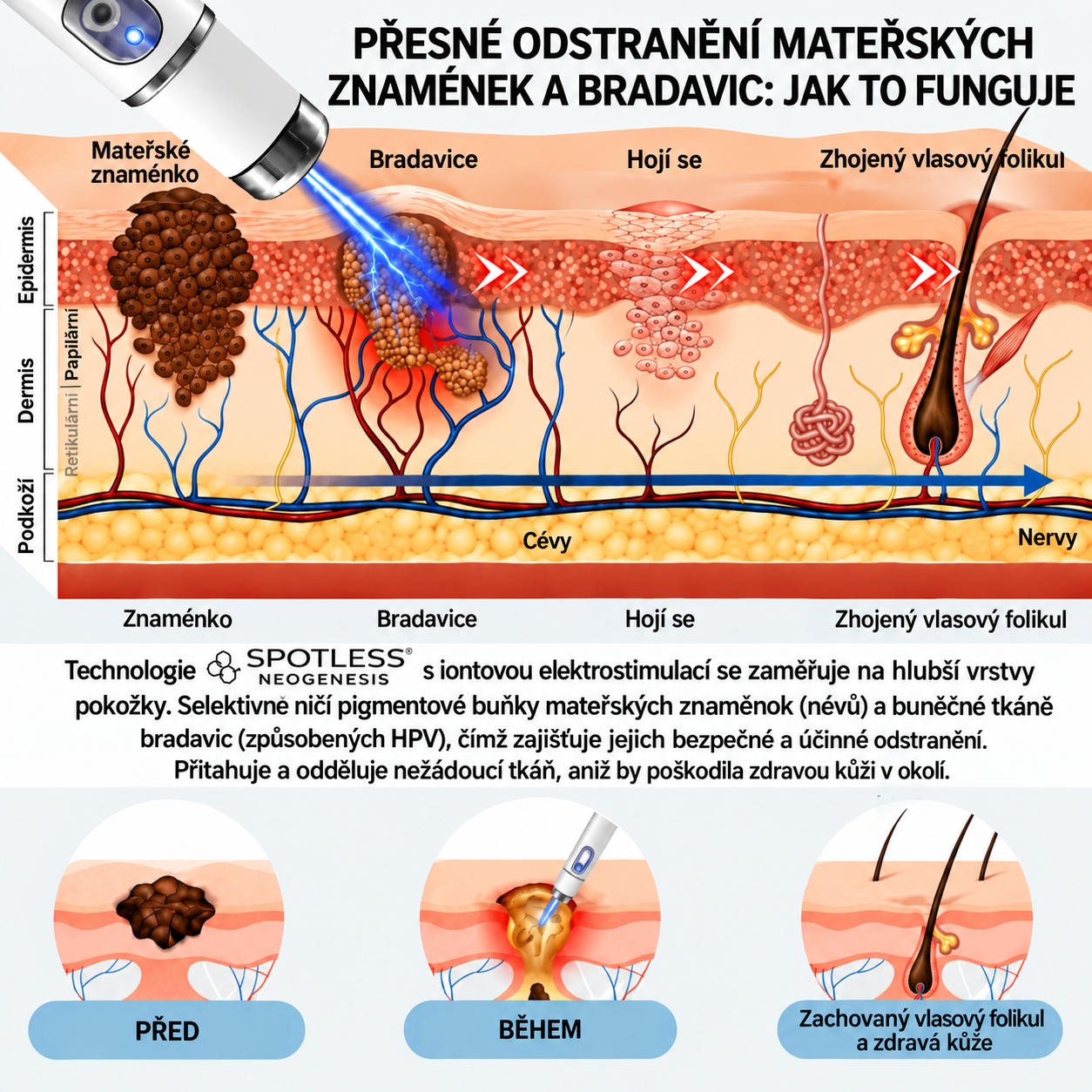 ✨ NEOGENESIS™ 2026 – Multifunkčná starostlivosť o pleť novej generácie v pere: profesionálne riešenie na odstránenie znamienok a nedokonalostí. Neinvazívna technológia bez bolesti a bez jaziev pre zdravšiu a žiarivejšiu pleť. Vyrobené v USA. ✨