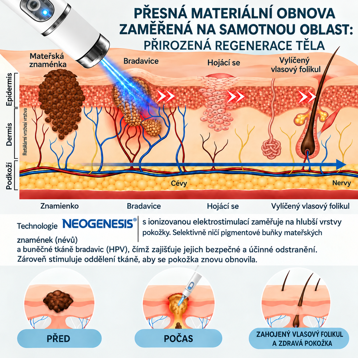 ✨ NEOGENESIS™ 2026 – Multifunkční péče o pleť nové generace v peru: profesionální řešení pro odstranění znamének a nedokonalostí. Neinvazivní technologie bez bolesti a bez jizev pro zdravější a zářivější pleť. Vyrobeno v USA. ✨