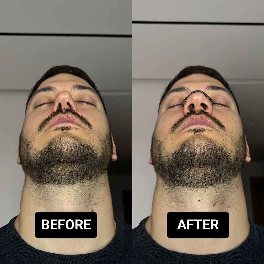 Breathe Easy™ Nasal Dilators