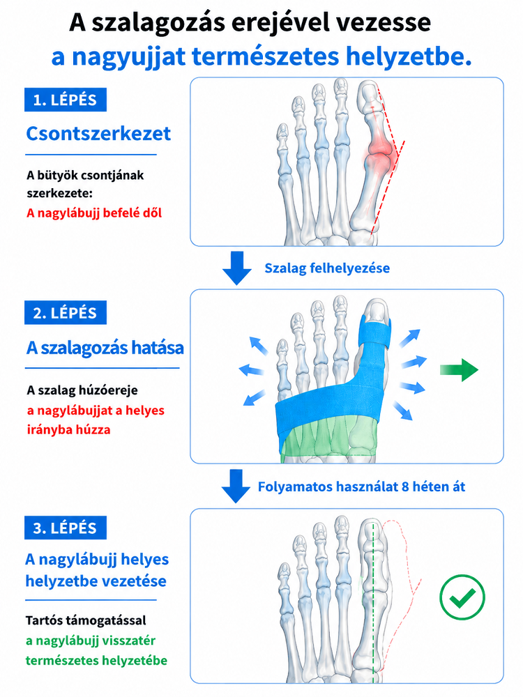 Láthatatlan Ultra-vékony Bütyökkorrigáló Pánt | Nappali Viselésre Cipőben is | Állítható Hallux Valgus Védő