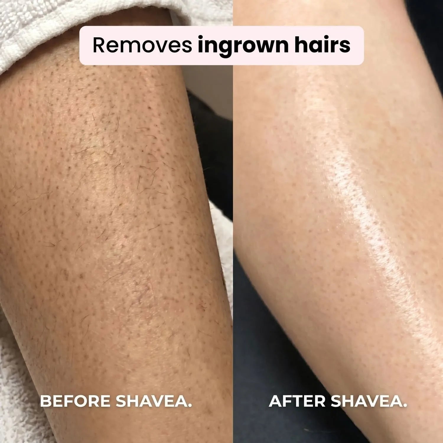 Shavea™ 2-in-1 Bikini & Body Trimmer