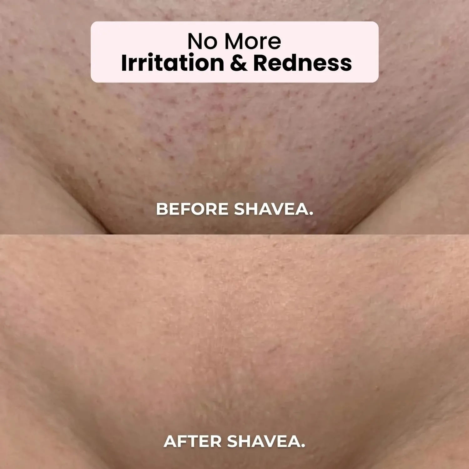 Shavea™ 2-in-1 Bikini & Body Trimmer