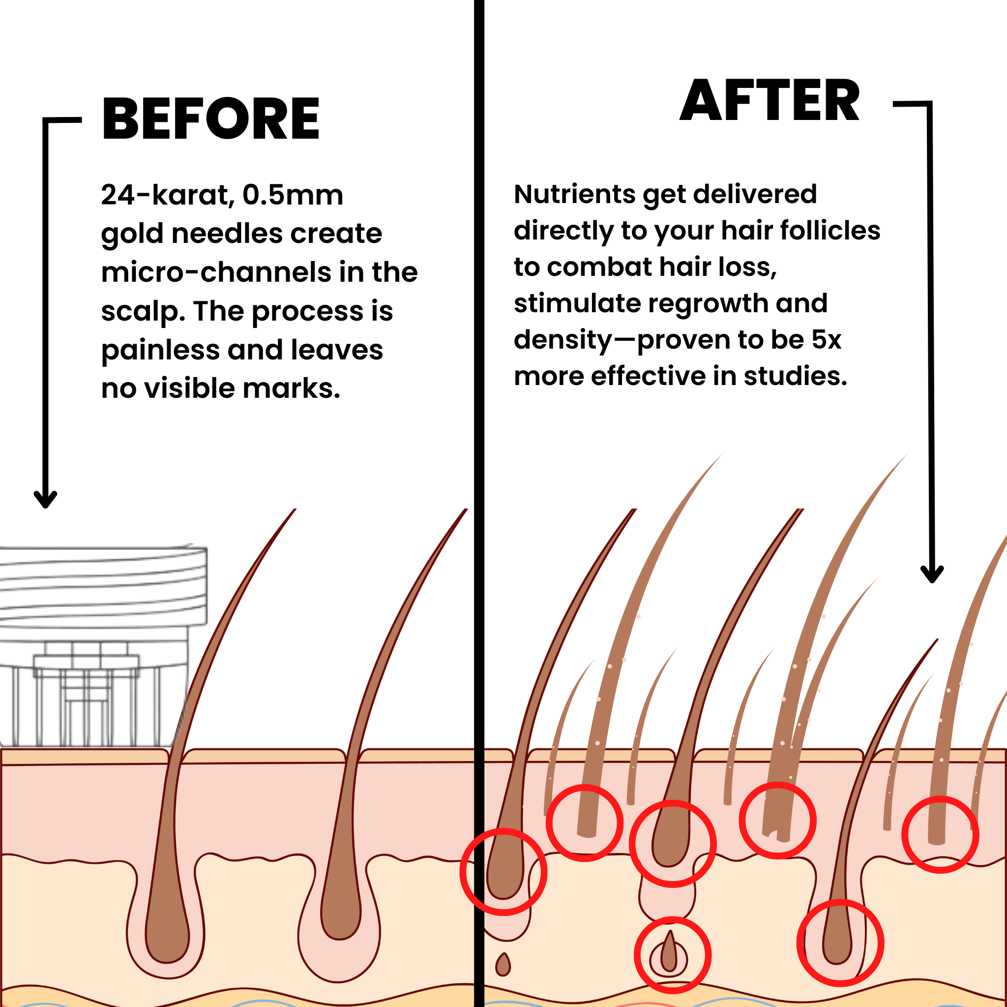 AlphaInfuse™ Hair Regrowth System