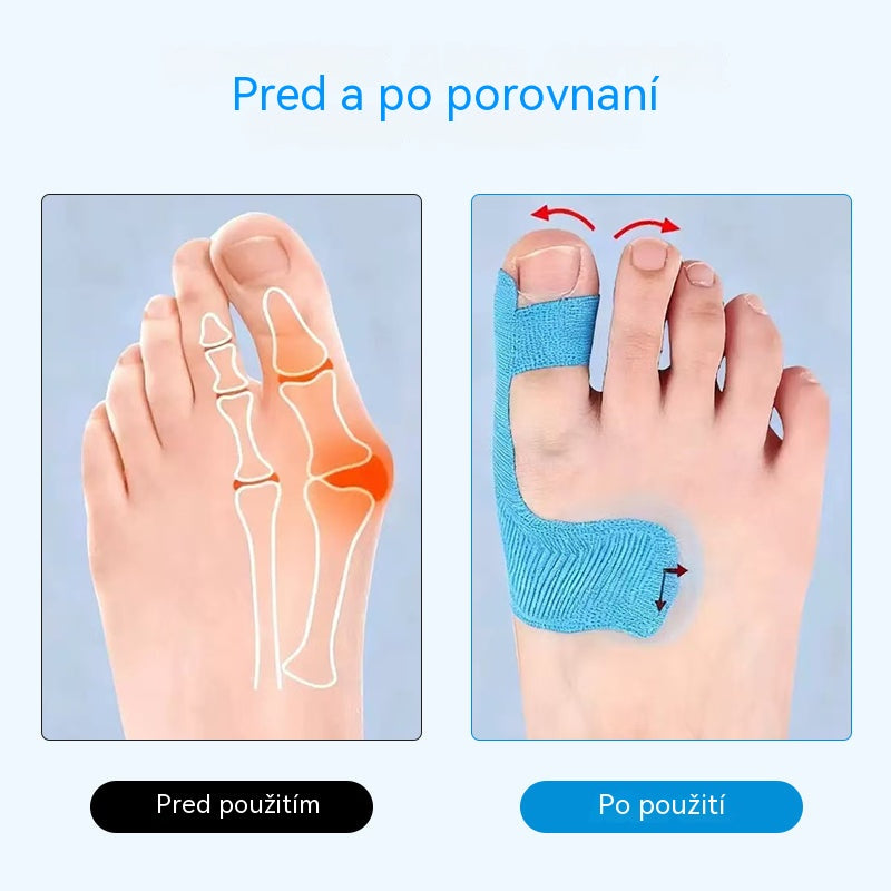✨👍【50 kusov - 26 eur】Flexibilný chránič prstov, podporná náplasť na popáleniny, športová bandáž odolná proti oderu