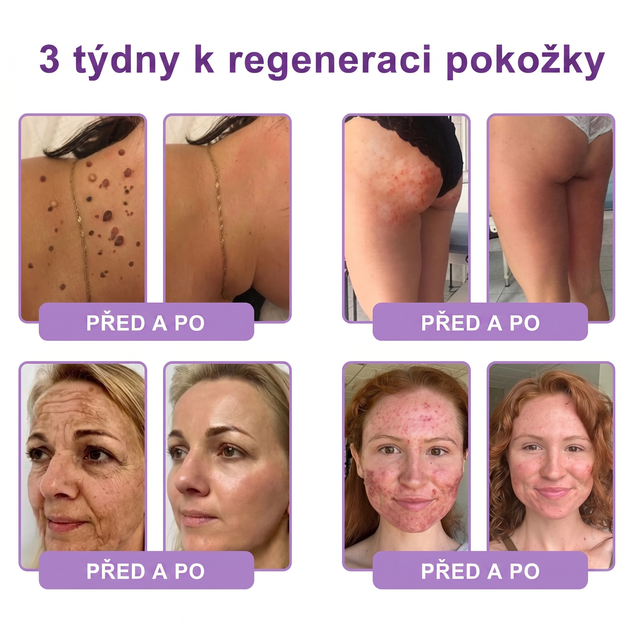 Oficiální obchod ✅ Vitalisys® PDRN vícepeptidový masážní tělový krém v kuličce ✨ – proti stárnutí, hydratační, zpevňující a liftingový efekt, podporuje regeneraci pleti, sjednocuje tón, redukuje nedokonalosti a zklidňuje citlivou pokožku 💎