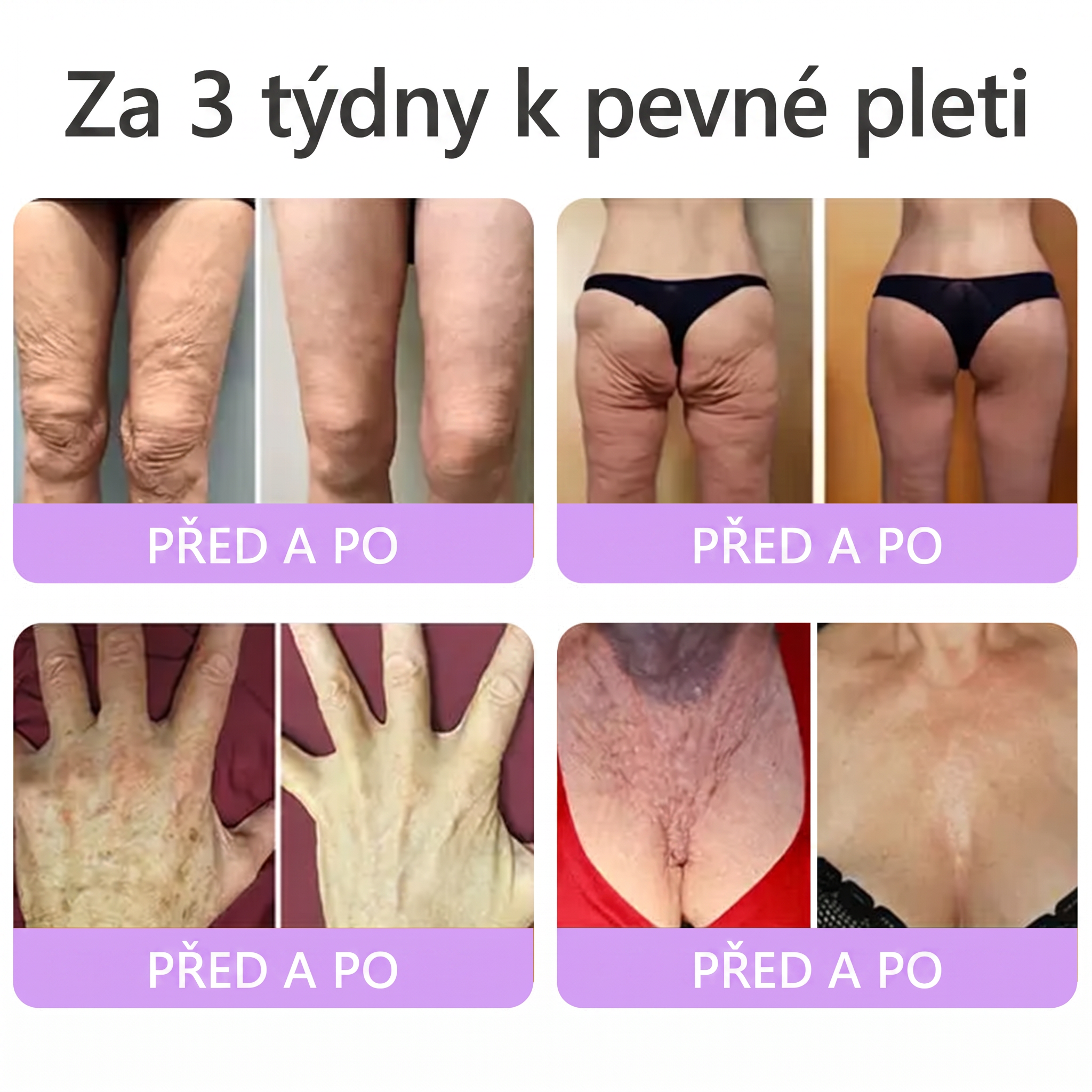 Oficiální obchod ✅ Vitalisys® PDRN vícepeptidový masážní tělový krém v kuličce ✨ – proti stárnutí, hydratační, zpevňující a liftingový efekt, podporuje regeneraci pleti, sjednocuje tón, redukuje nedokonalosti a zklidňuje citlivou pokožku 💎