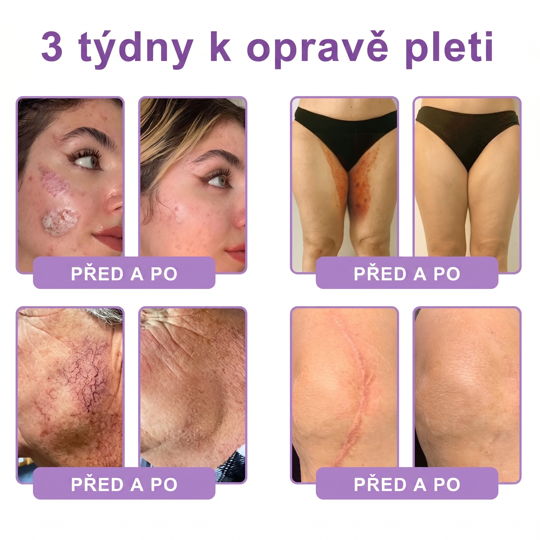 Oficiální obchod ✅ Vitalisys® PDRN vícepeptidový masážní tělový krém v kuličce ✨ – proti stárnutí, hydratační, zpevňující a liftingový efekt, podporuje regeneraci pleti, sjednocuje tón, redukuje nedokonalosti a zklidňuje citlivou pokožku 💎