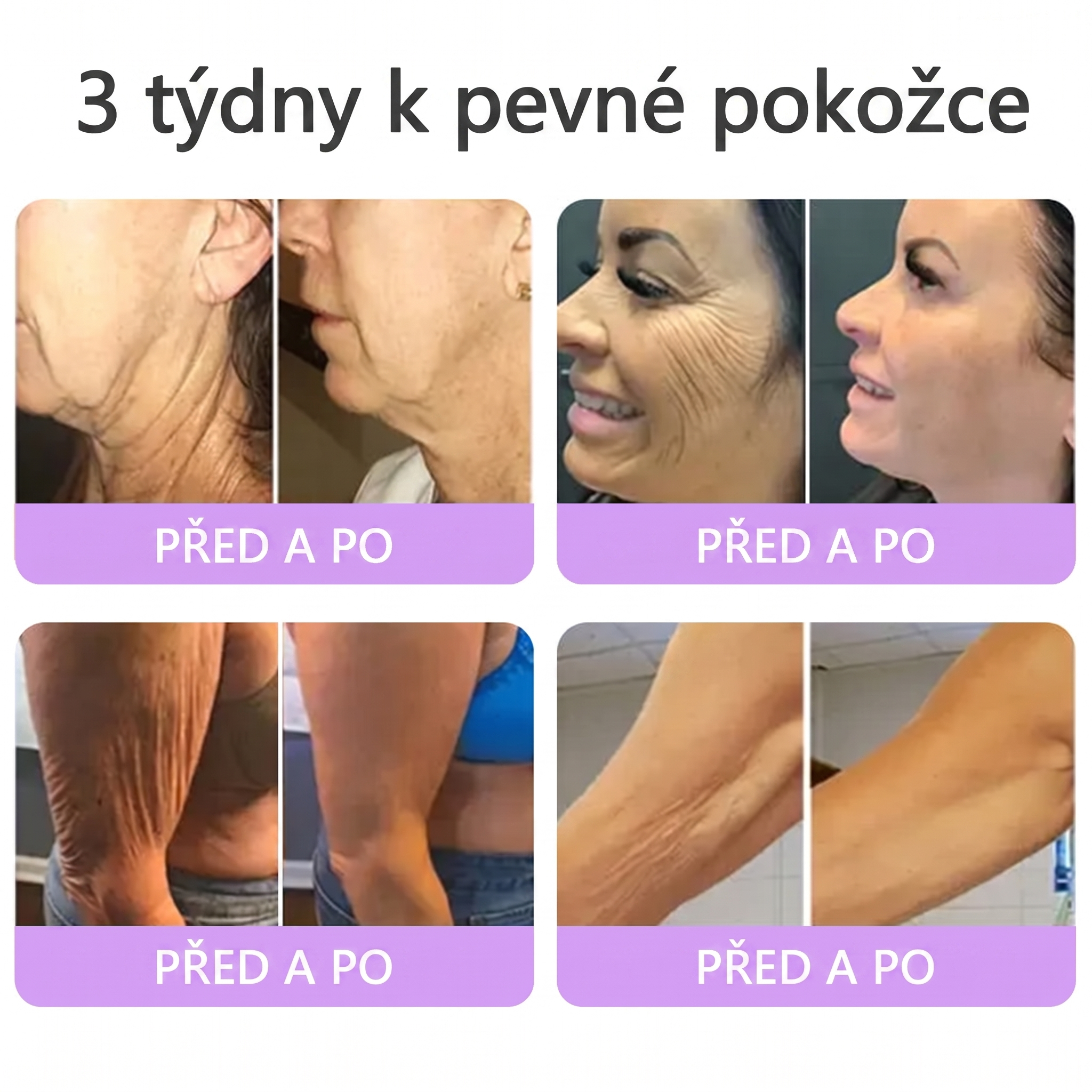 Oficiální obchod ✅ Vitalisys® PDRN vícepeptidový masážní tělový krém v kuličce ✨ – proti stárnutí, hydratační, zpevňující a liftingový efekt, podporuje regeneraci pleti, sjednocuje tón, redukuje nedokonalosti a zklidňuje citlivou pokožku 💎
