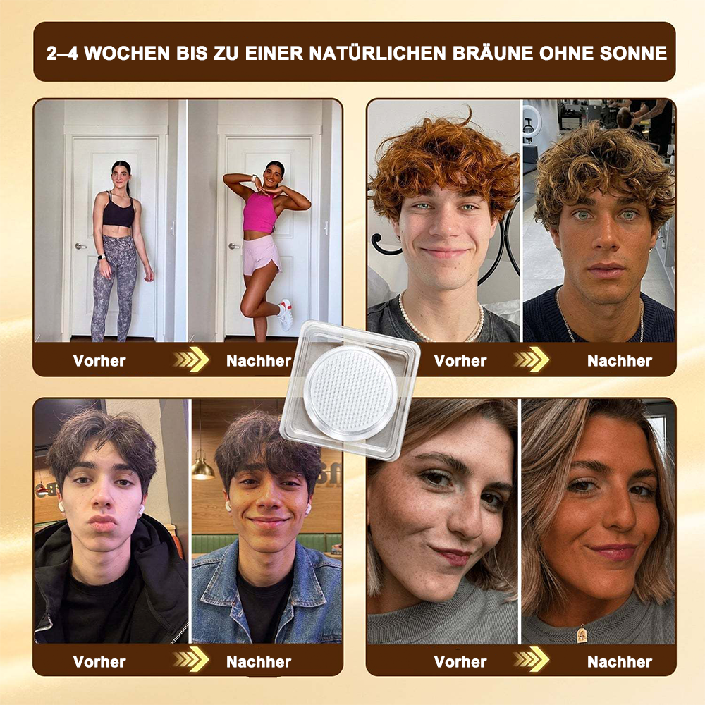 Offizieller Store | ☀️☀️ Purelora® Sofort-Bräunungs-Mikronadelpflaster ohne Sonne 🇩🇪 Nur 1× täglich anwenden | Sichtbar bronzene Bräune in nur 7 Tagen ✅ Kein UV • Kein Orangestich • Keine Streifen • Kein DHA • Kein Schmutz