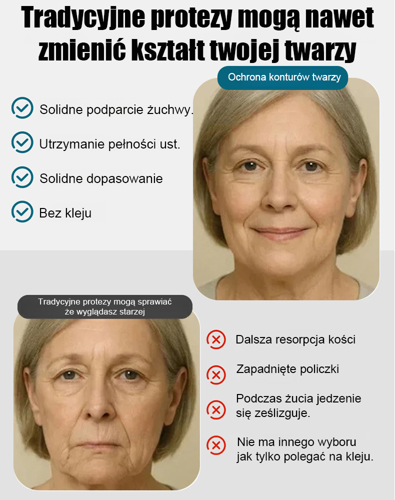 【Kup 2, Odbierz 2 Gratis】Zestaw do Natychmiastowego Uśmiechu - Bezbolesne Licówki Kosmetyczne