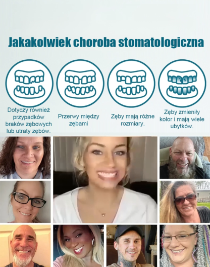 【Kup 2, Odbierz 2 Gratis】Zestaw do Natychmiastowego Uśmiechu - Bezbolesne Licówki Kosmetyczne