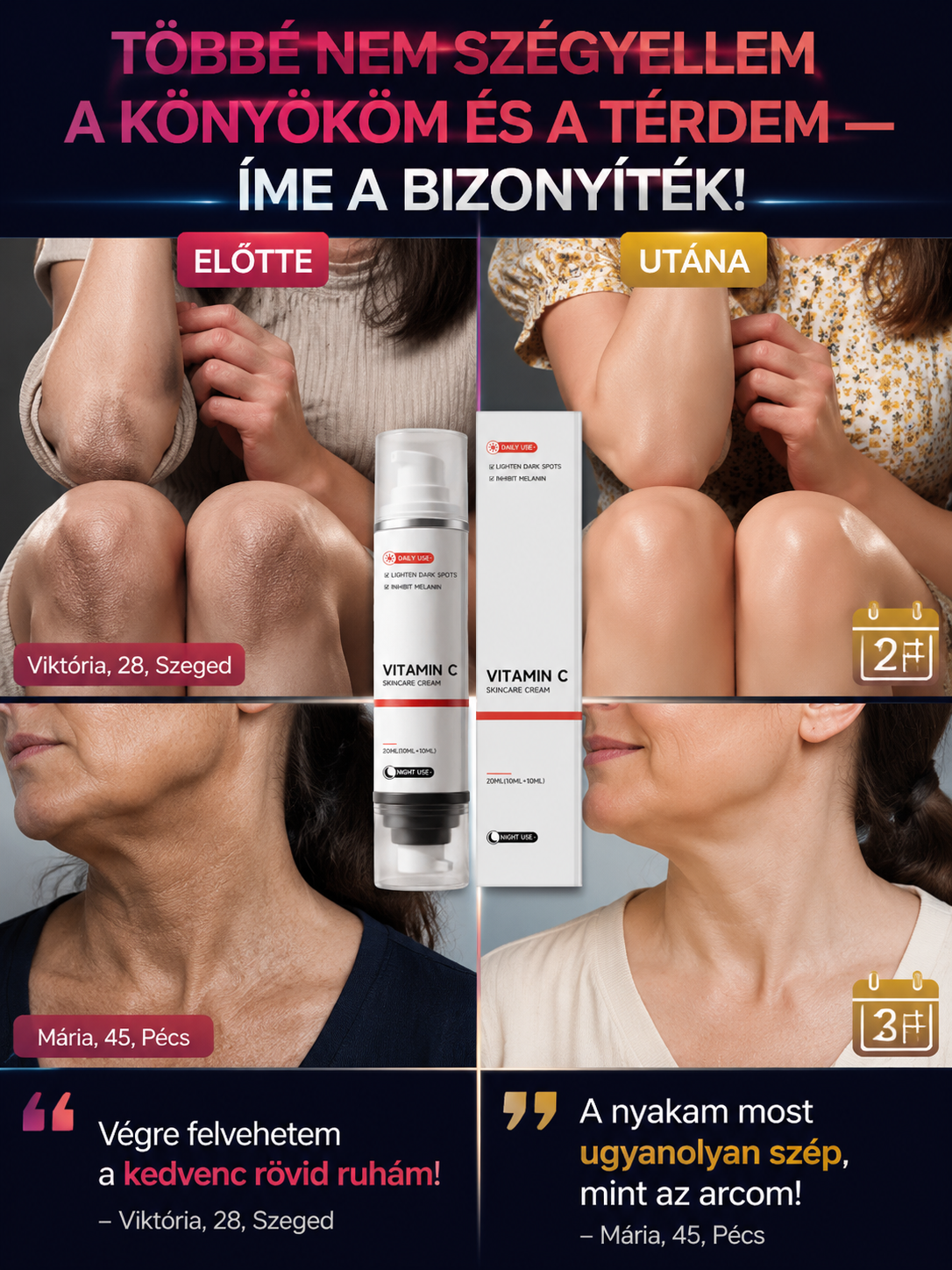 ✨Azonnali fehérítő és folthalványító testkrém✨