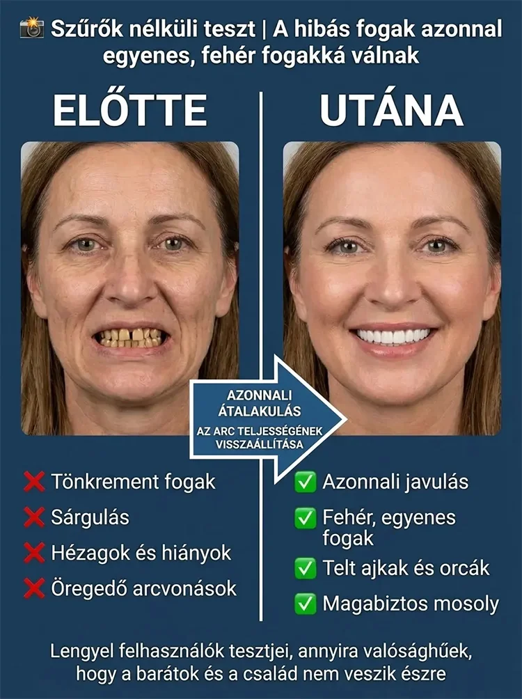 Teljesen borító, élelmiszer-minőségű fogszabályzó sín