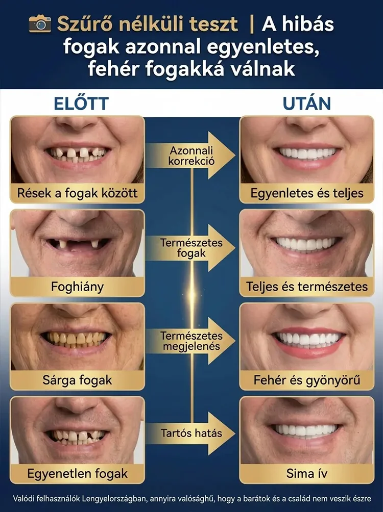 Teljesen borító, élelmiszer-minőségű fogszabályzó sín