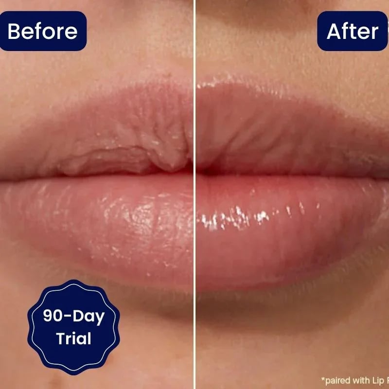 🔥Rabatt zum halben Preis🔥🔥Lippenserum mit Vitamin E