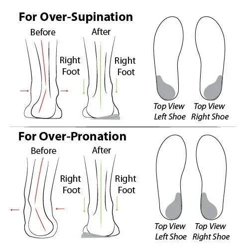🔥Last Day 49%🔥2023 Women Casual Summer Daily Comfy Slip On Sandals