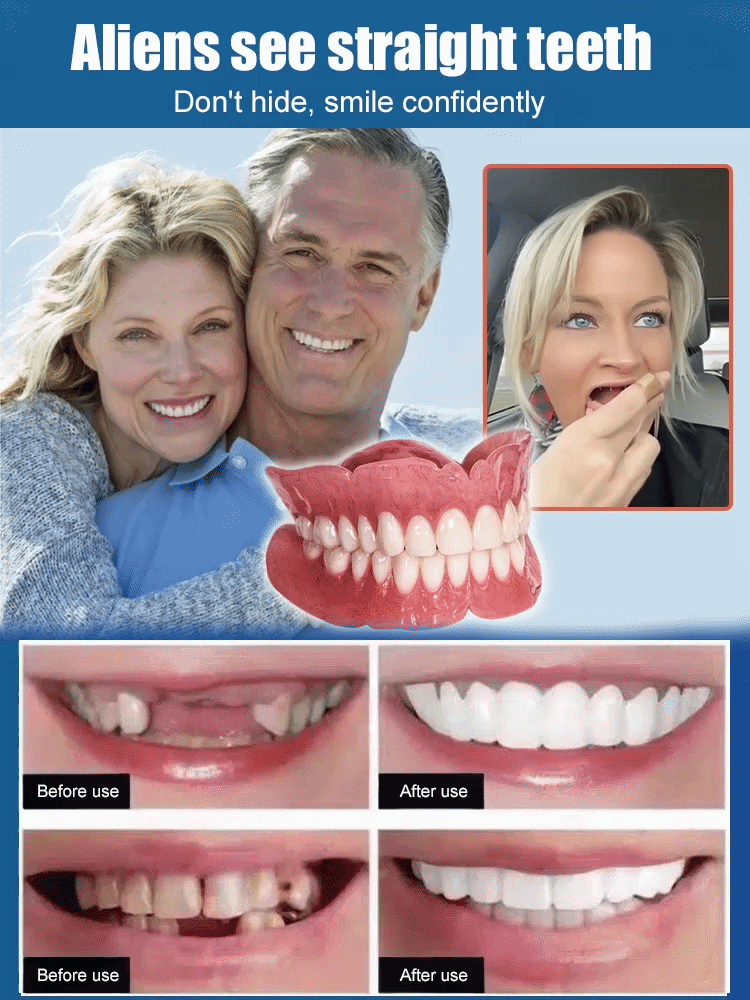 【Limited-Time Offer: Save 49%】Perfect Smile Dentures