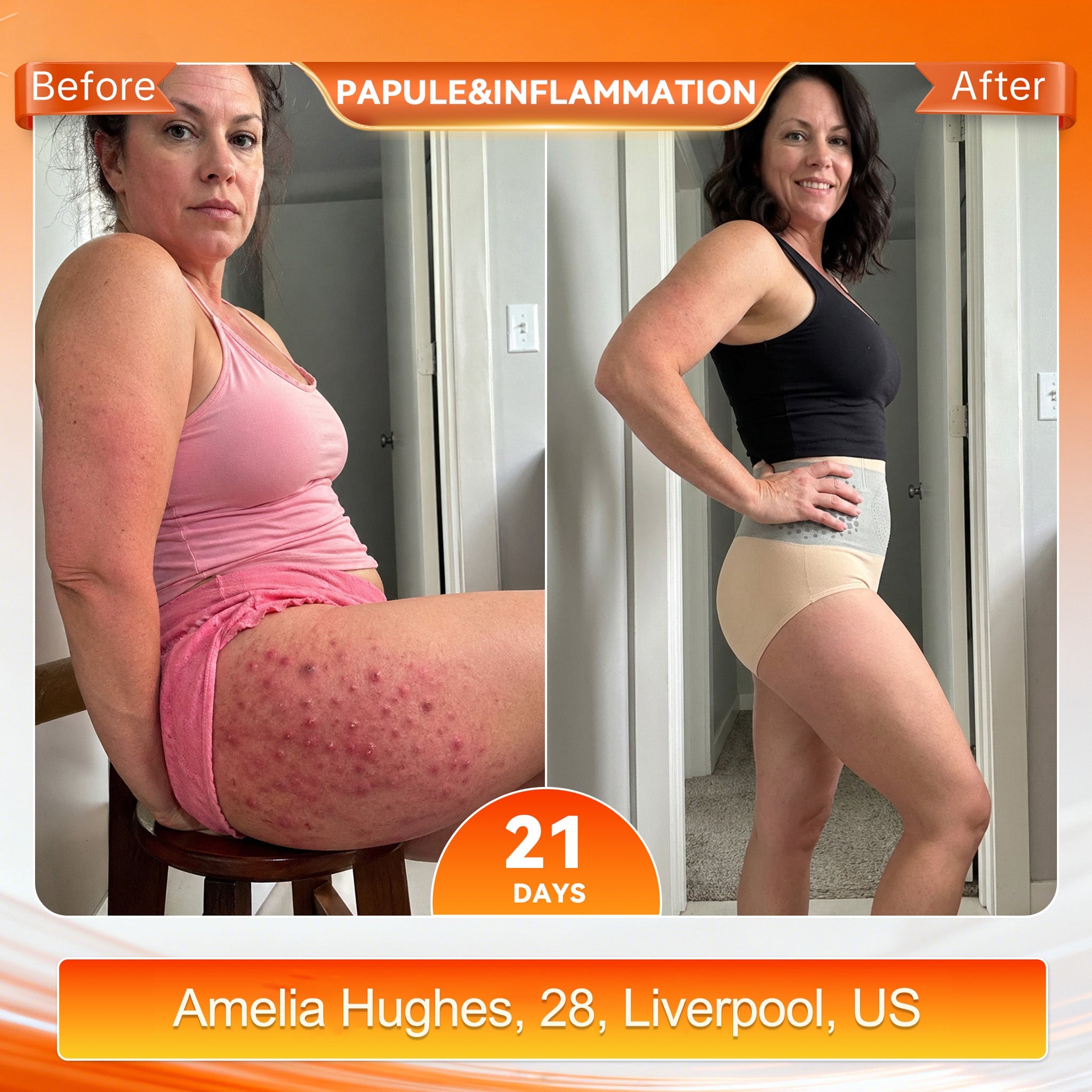 𝟒-𝐈𝐧-𝟏 𝐌𝐢𝐜𝐫𝐨-𝐏𝐚𝐫𝐭𝐢𝐜𝐥𝐞 𝐒𝐜𝐮𝐥𝐩𝐭𝐢𝐧𝐠 & 𝐅𝐚𝐭-𝐁𝐮𝐫𝐧 𝐒𝐡𝐨𝐫𝐭𝐬
