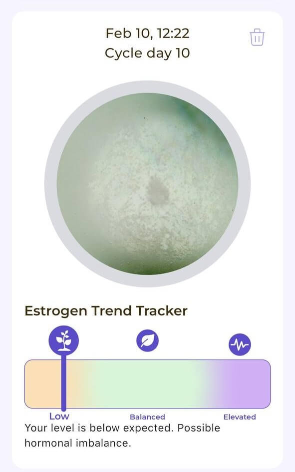 Ovul AI estrogen trend tracker showing low levels on cycle day 10 in user with PCOS