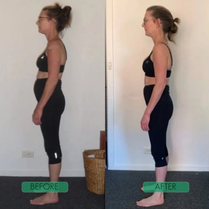 Back Posture Corrector