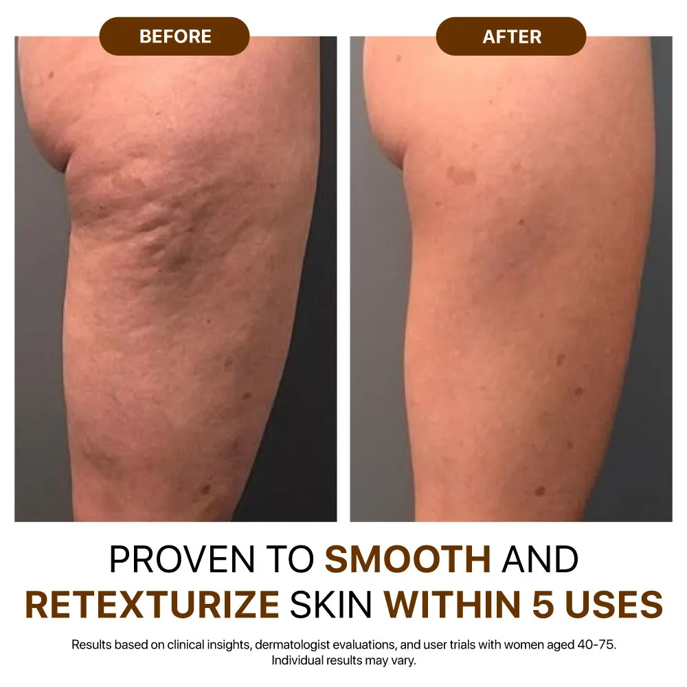 Leg texture comparison before and after consistent body-oil use