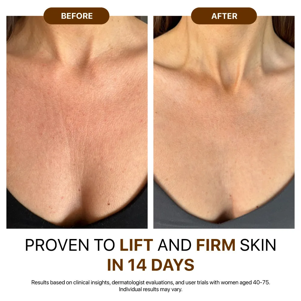 Neck and chest skin comparison before and after a moisturizing routine