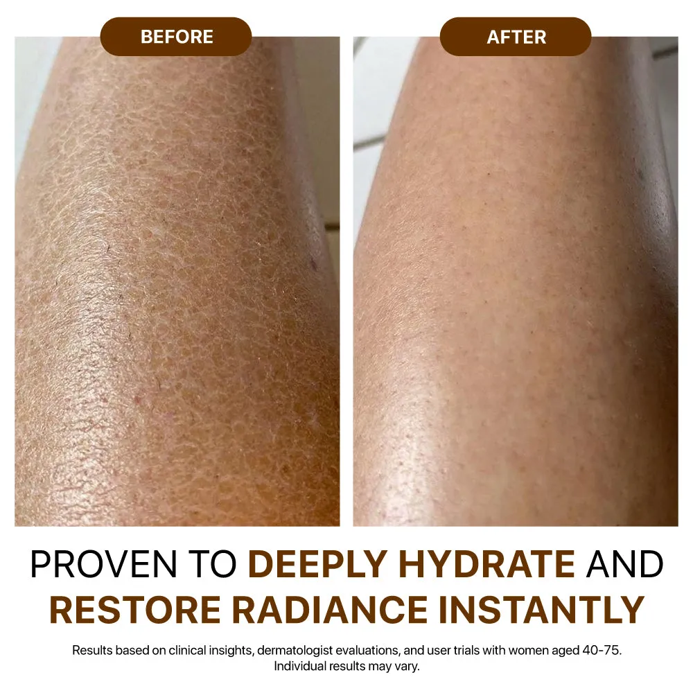 Dry leg skin compared with a moisturized radiant finish