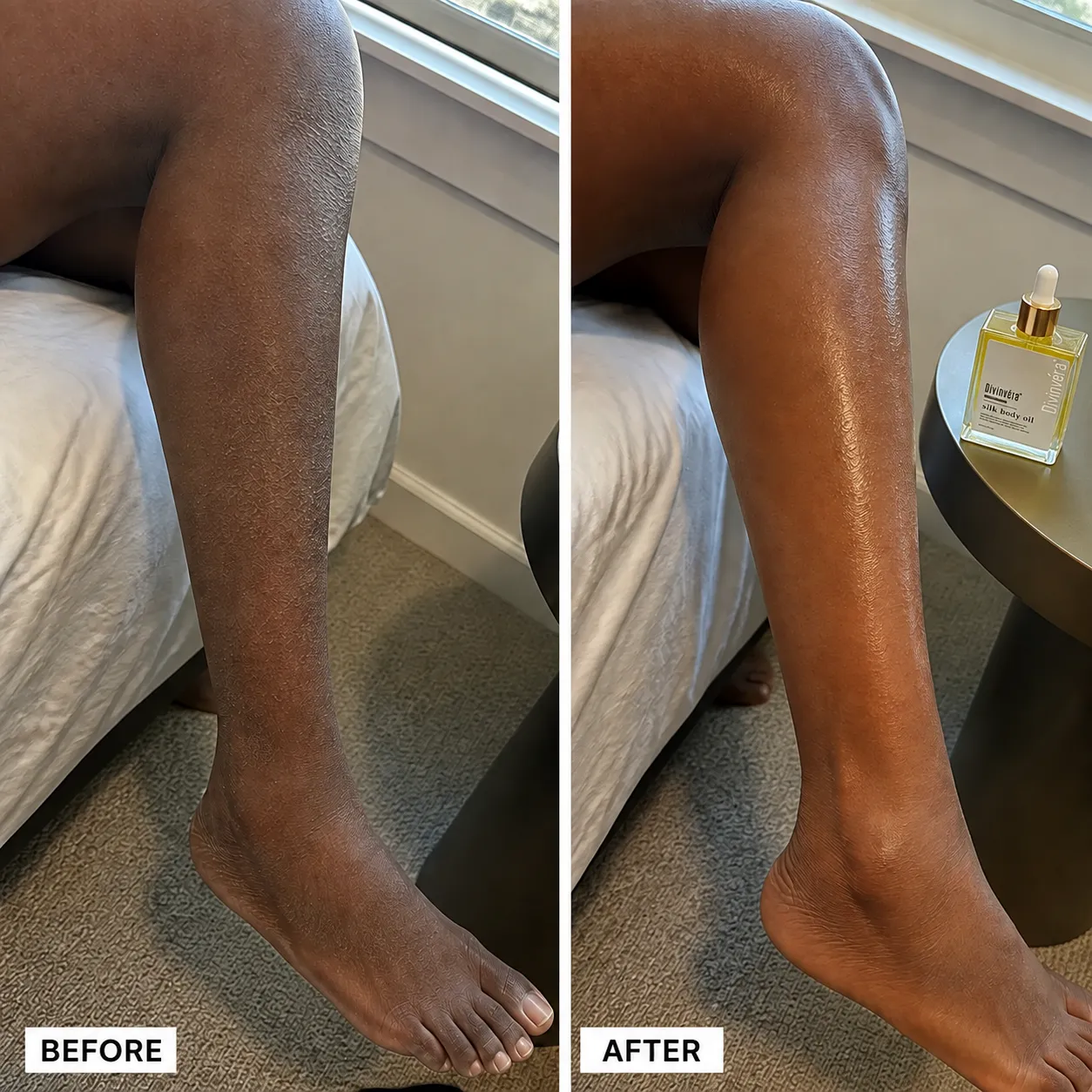 Dry shin before and after a moisturizing body-oil routine