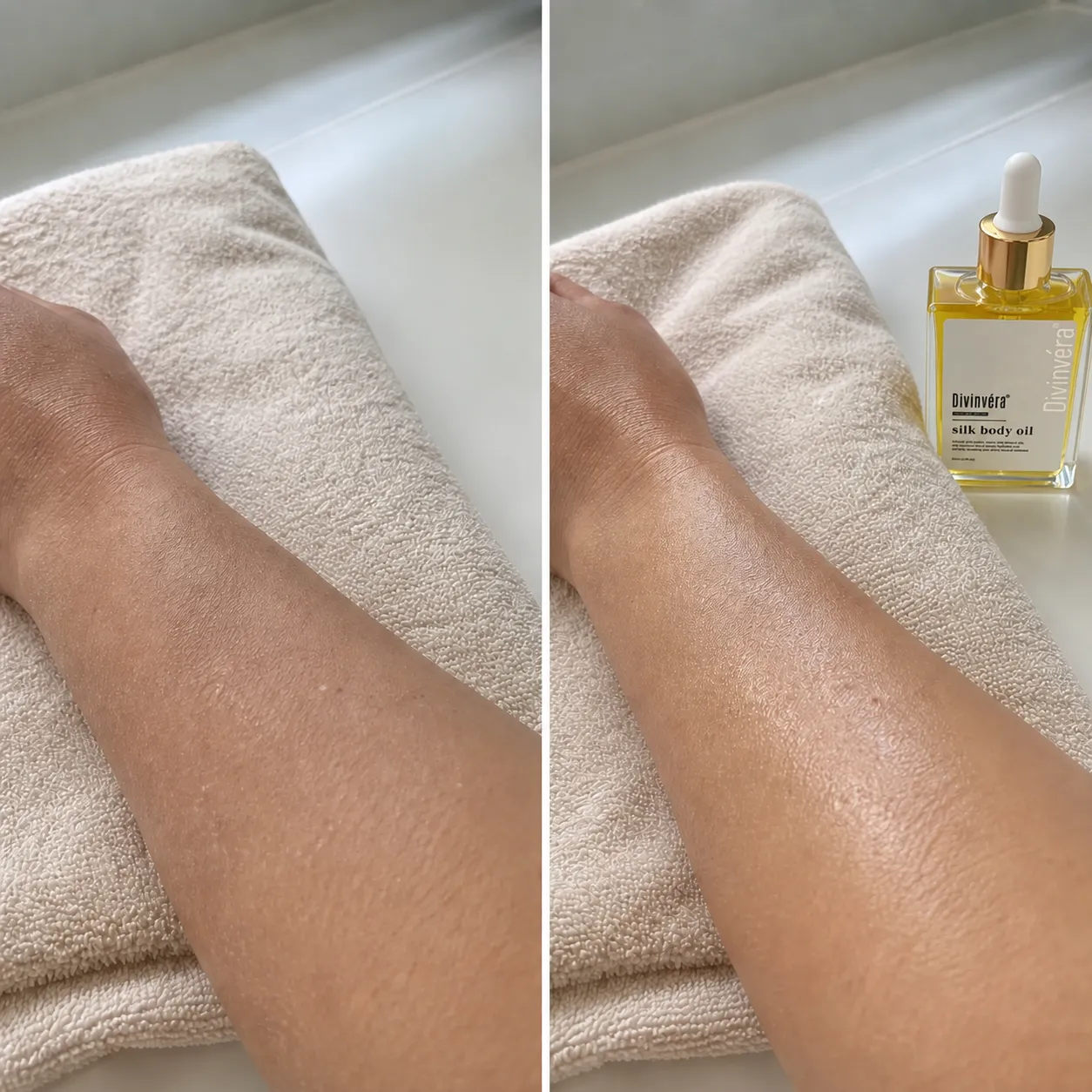 Forearm dryness before and after a moisturizing body-oil routine