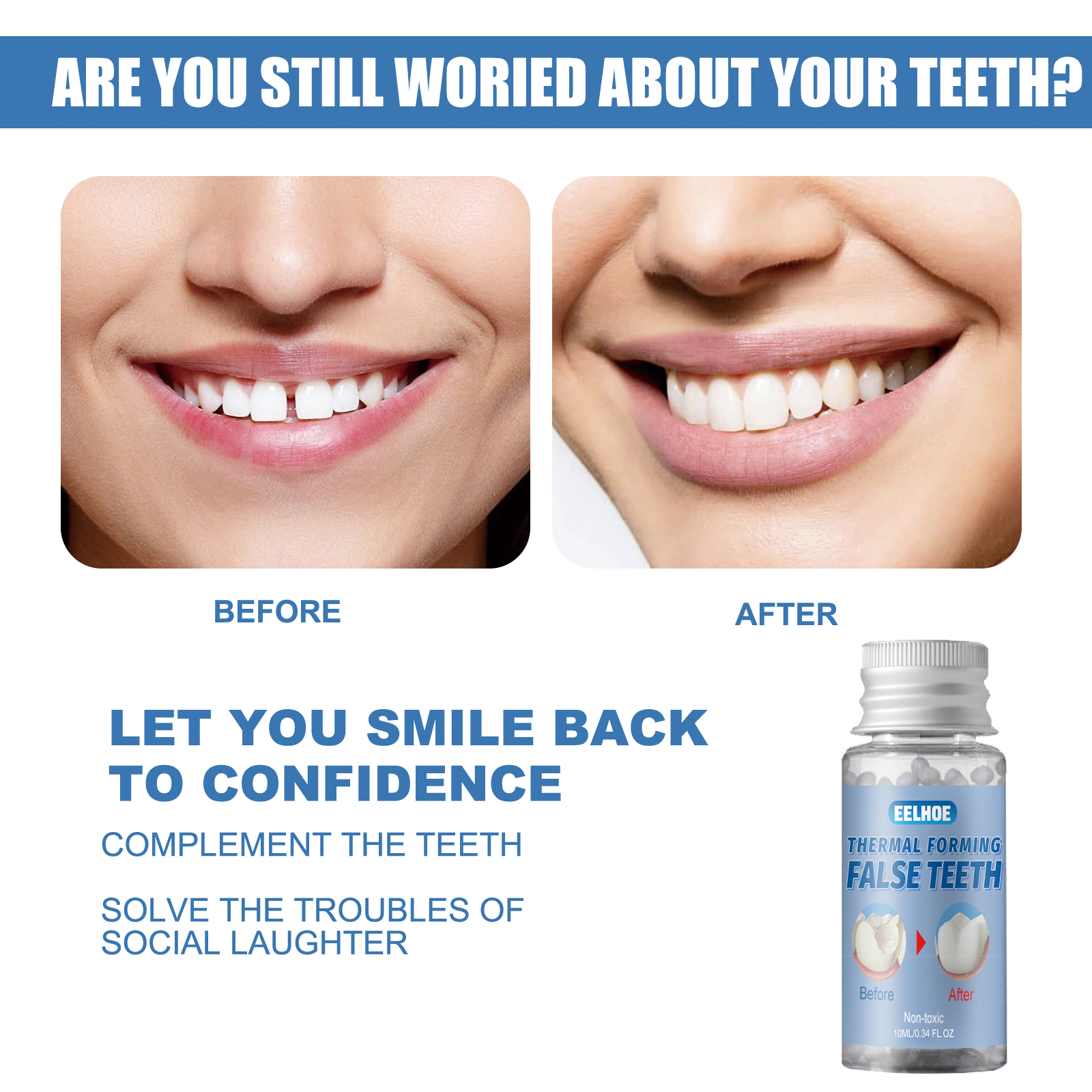 Instant Smile Temporary Tooth Repair Kit – Moldable Thermal Beads for Missing Teeth