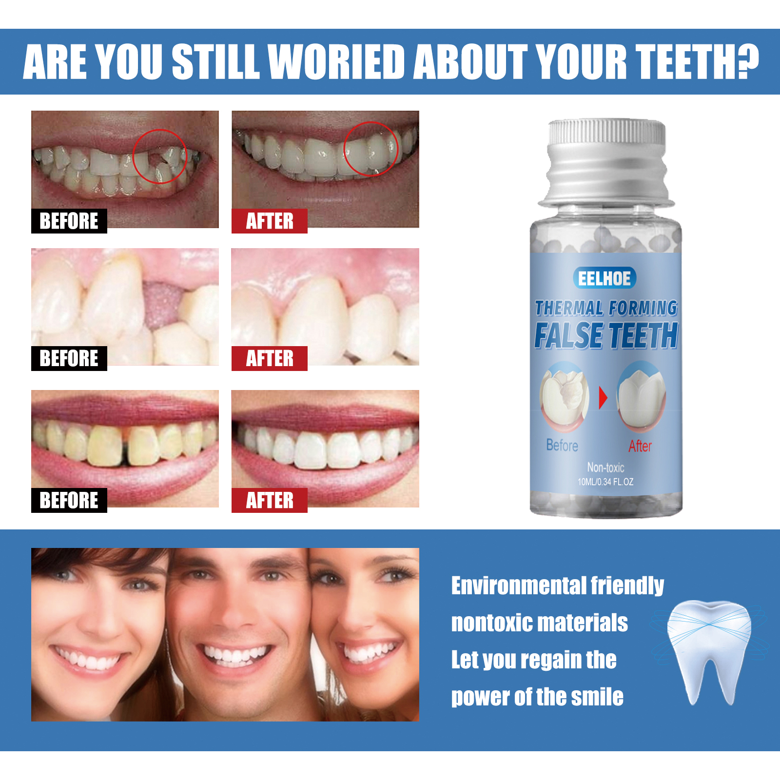 Instant Smile Temporary Tooth Repair Kit – Moldable Thermal Beads for Missing Teeth