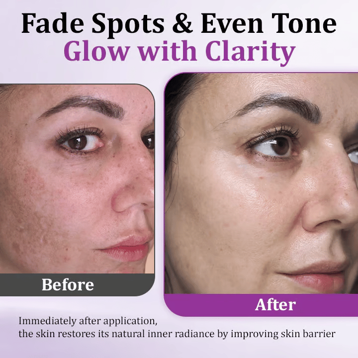 MelantraX Advanced Anti-Hyperpigmentation Essence