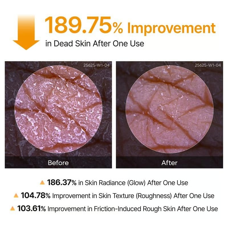 🌸 New! Peel Shot Keratin Care Kojic Acid Turmeric Spray