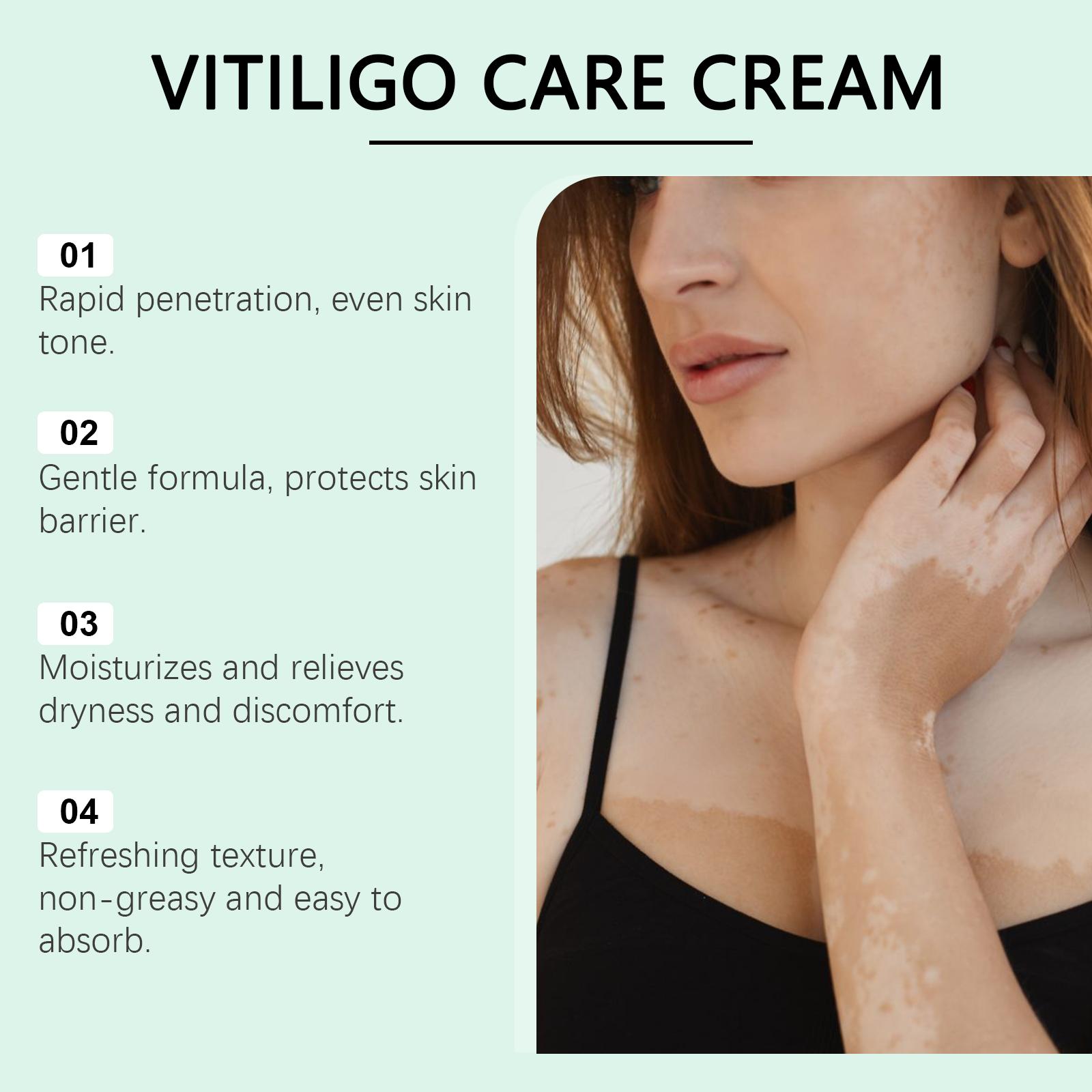 Vitiligo Care Cream to Help Restore Pigmentation and Reduce White Spots - Natural Plant-Based Body Care Moisturizer for All Skin Types Vitiligo Care Cream to Help Restore Pigmentation and Reduce White Spots - Natural Plant-Based Body Care Moisturizer for All Skin Types