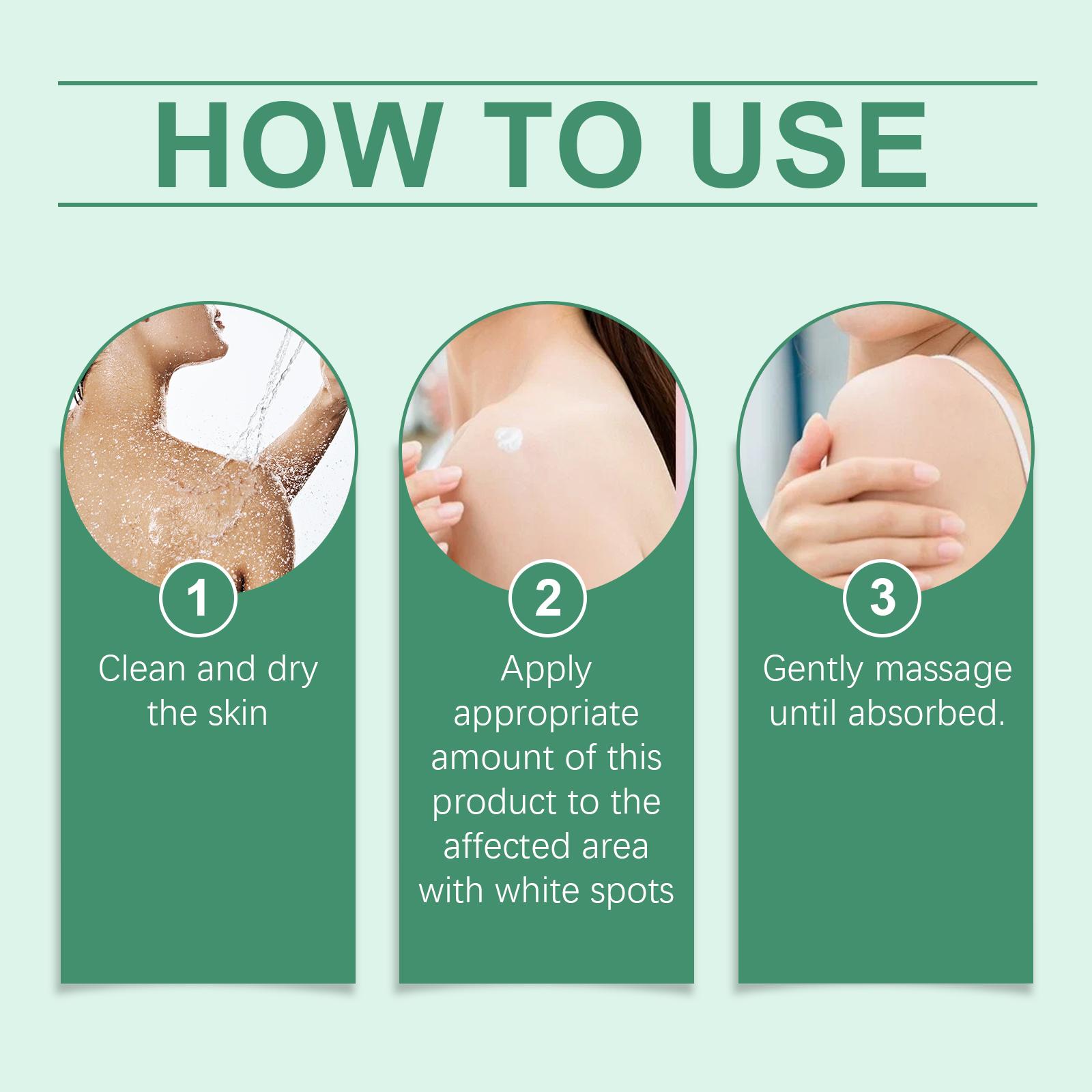 Vitiligo Care Cream to Help Restore Pigmentation and Reduce White Spots - Natural Plant-Based Body Care Moisturizer for All Skin Types Vitiligo Care Cream to Help Restore Pigmentation and Reduce White Spots - Natural Plant-Based Body Care Moisturizer for All Skin Types