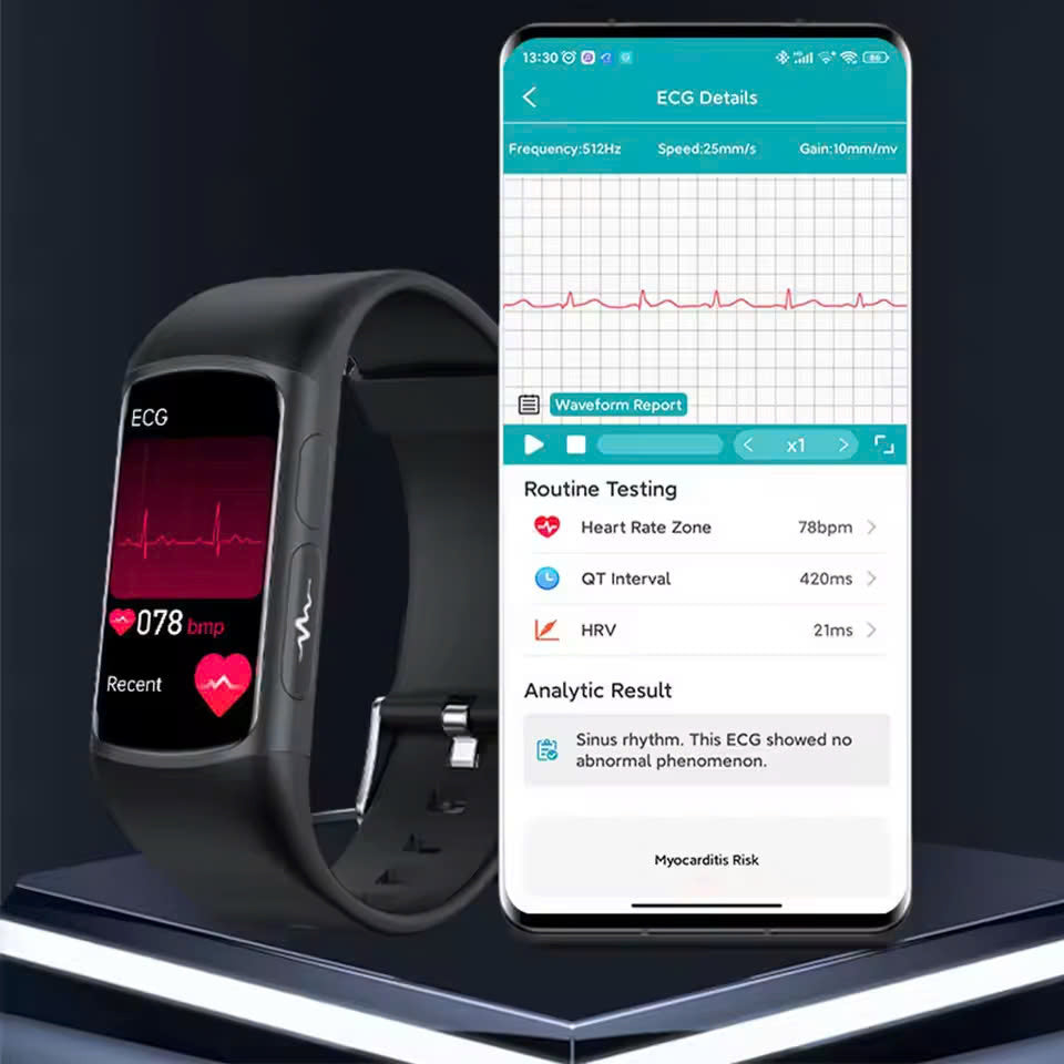  ActiveCore Fusion - Medical Grade Smart Watch Blood Sugar Blood Lipid Uric Acid ECG+PPG Body Temperature
